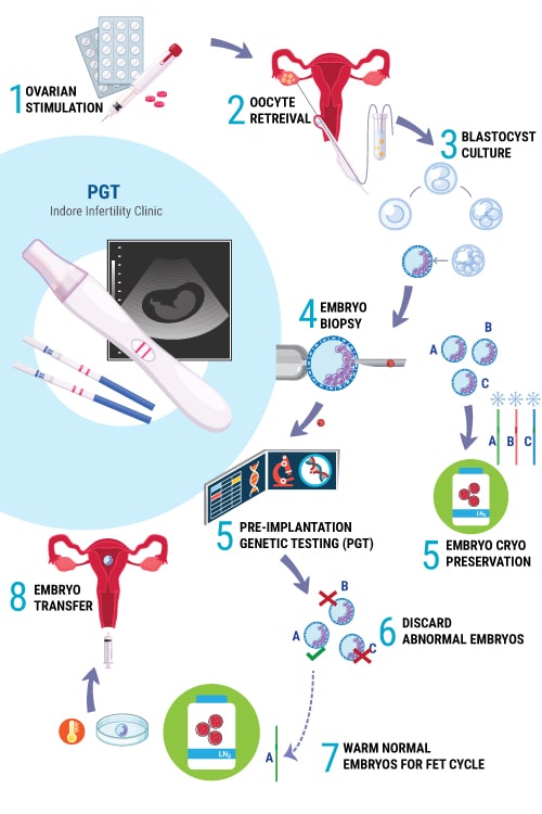 Steps of an IVF-PGT cycle
