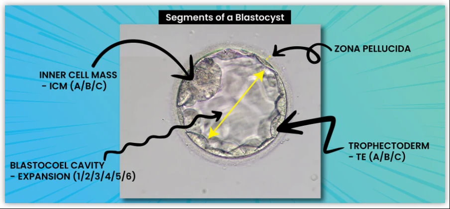 Segments of a blastocyst: inner cell mass, trophectoderm, blastocoel cavity and zona pellucida