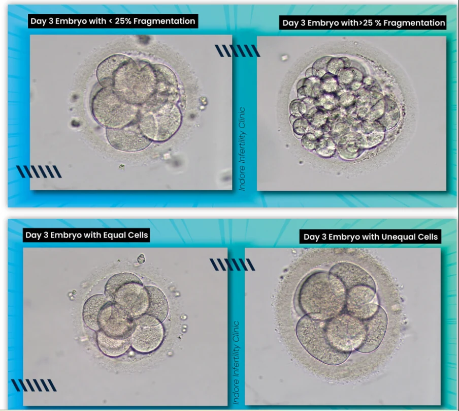 Day 3 embryos compared by fragmentation and by cell symmetry