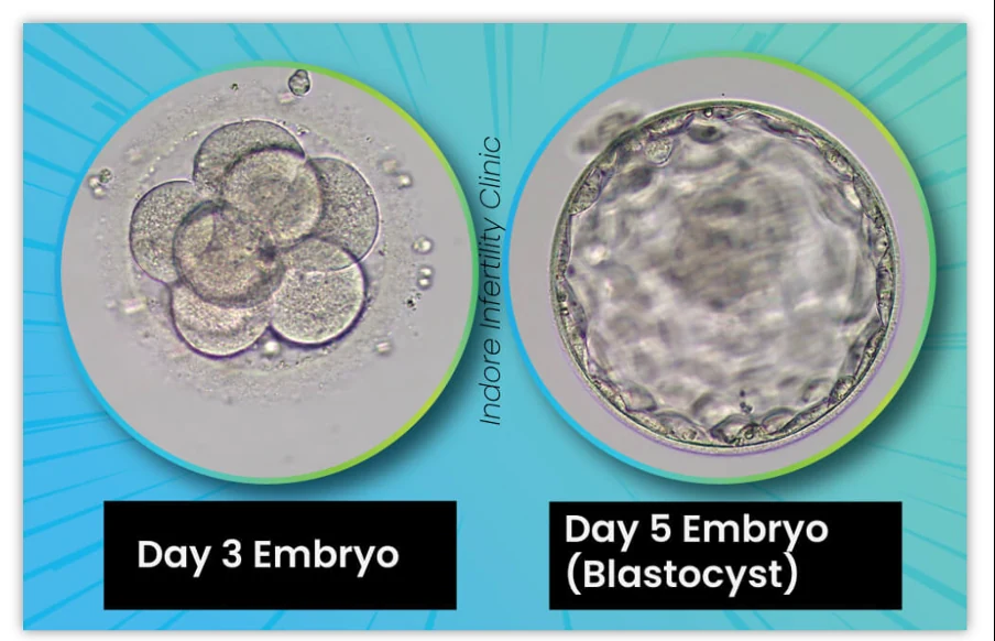 Day 3 embryo and Day 5 embryo (blastocyst)