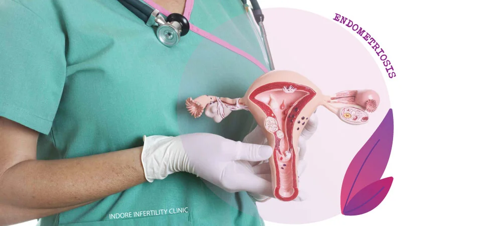 Endometriosis