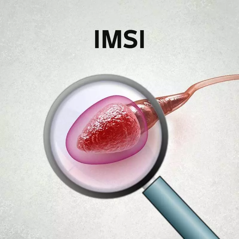 IMSI intracytoplasmic morphologically selected sperm injection treatment