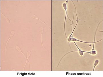 Bright field versus phase contrast microscope view of sperms