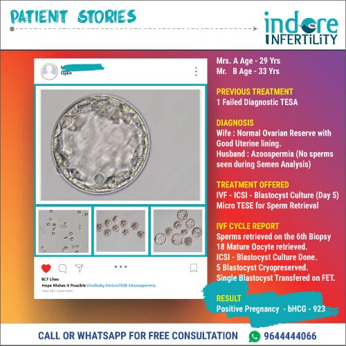 Patient story about Klinefelter syndrome and Micro TESE
