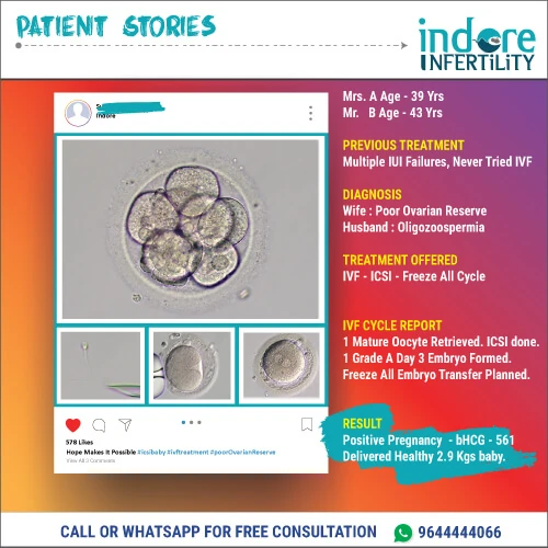 Patient story with very poor ovarian reserve and one egg